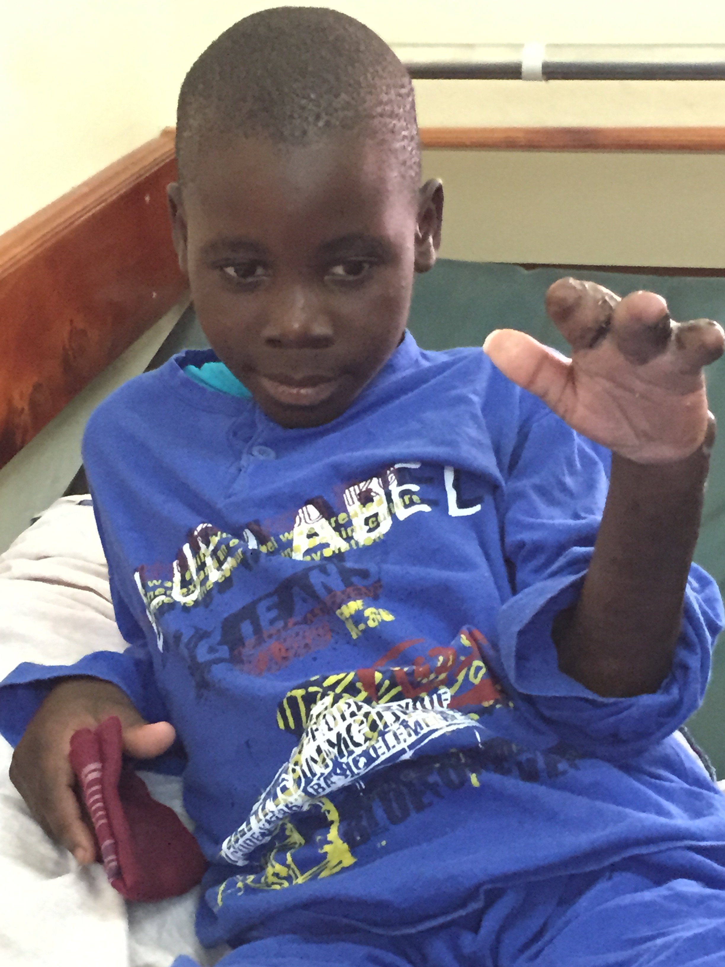 "Dona un sorriso ai bambini ustionati" di HFL "Dona un sorriso ai bambini ustionati"-HFL