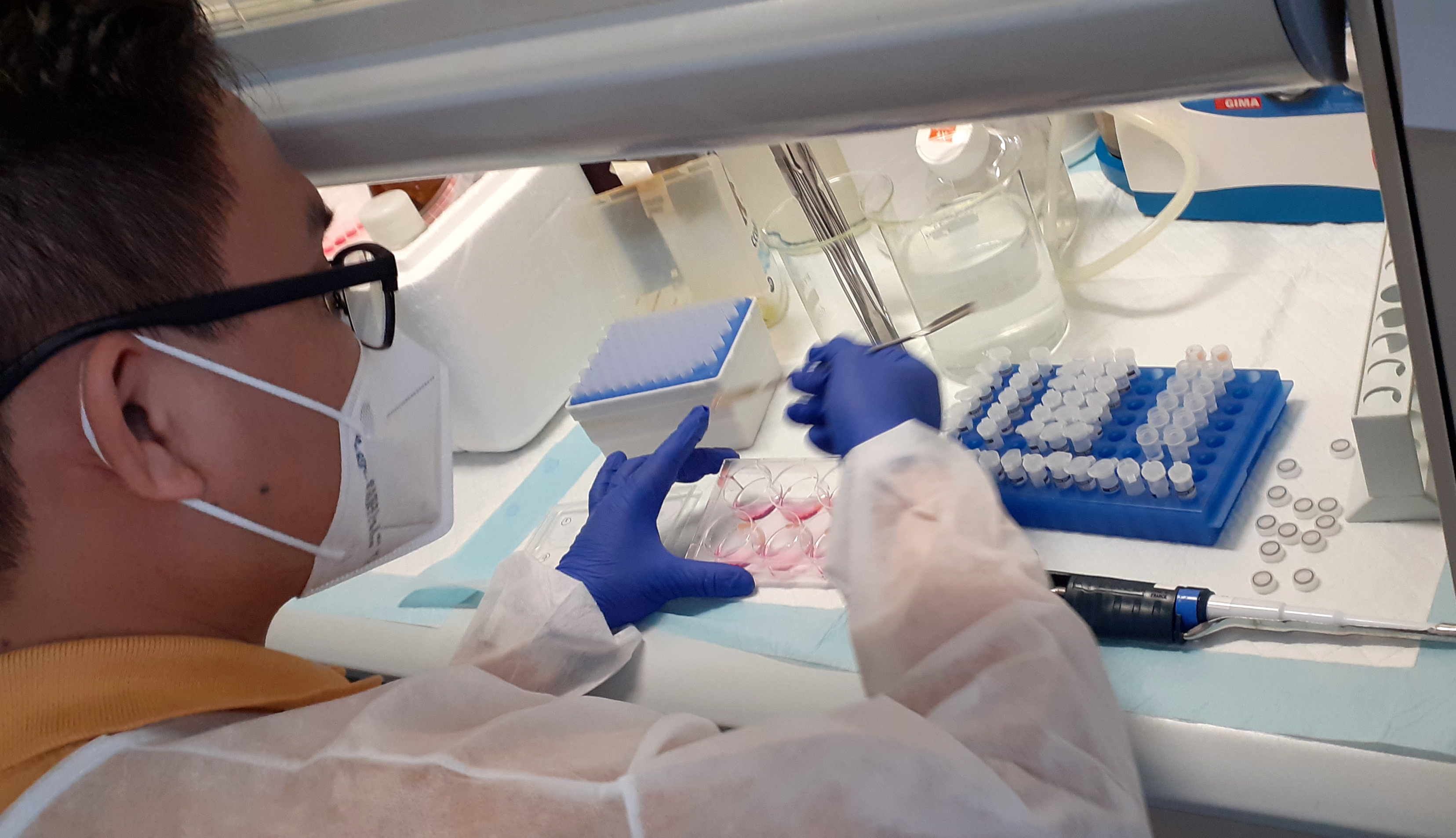 Progetto LIVER-BRAIN "Rita Moretti" di Fondazione Italiana Fegato - FIF Onlus Progetto LIVER-BRAIN "Rita Moretti"-Fondazione Italiana Fegato - FIF Onlus