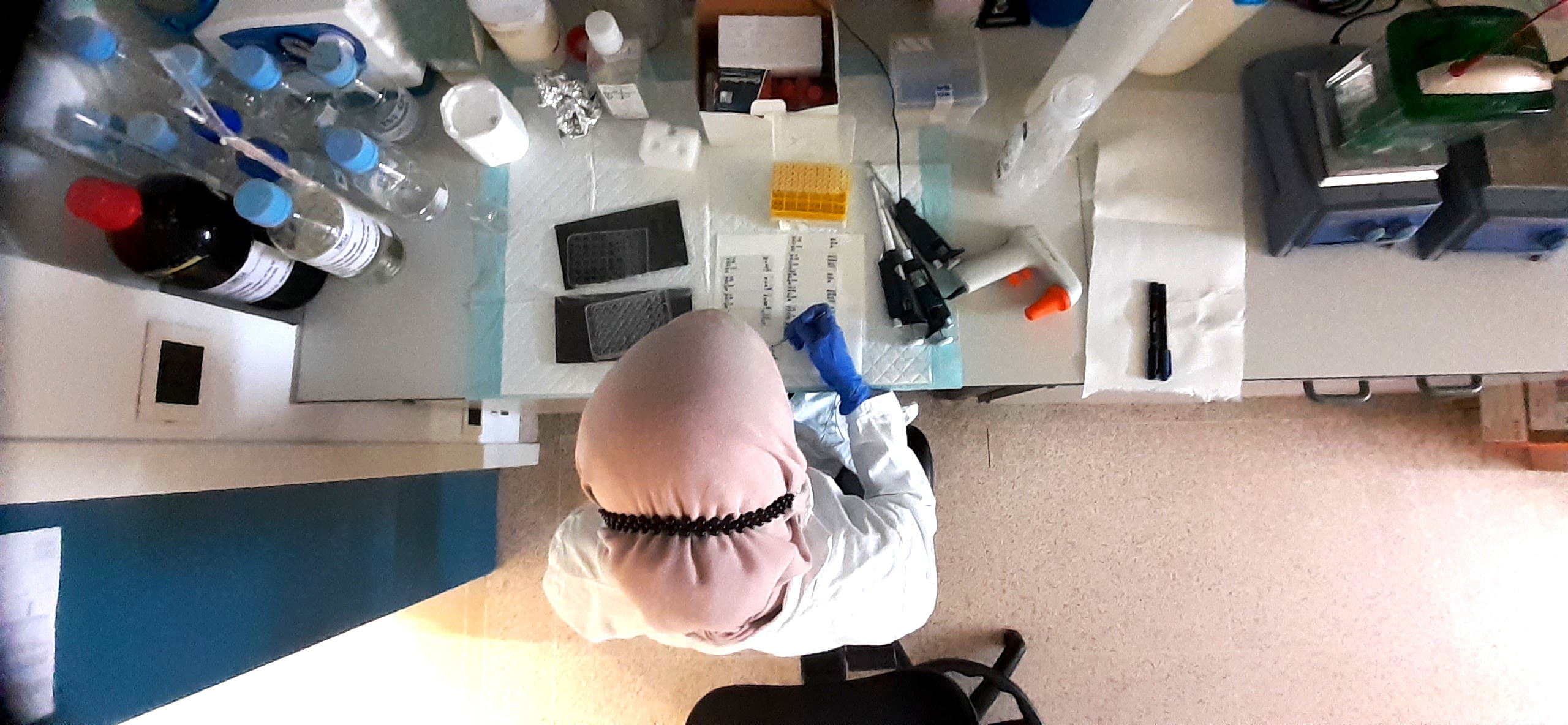 Progetto LIVER-BRAIN "Rita Moretti" di Fondazione Italiana Fegato - FIF Onlus Progetto LIVER-BRAIN "Rita Moretti"-Fondazione Italiana Fegato - FIF Onlus