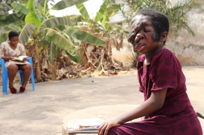 Una corsa per Tina di Linfa+Ananas contro le neurofibromatosi Una corsa per Tina-Linfa+Ananas contro le neurofibromatosi