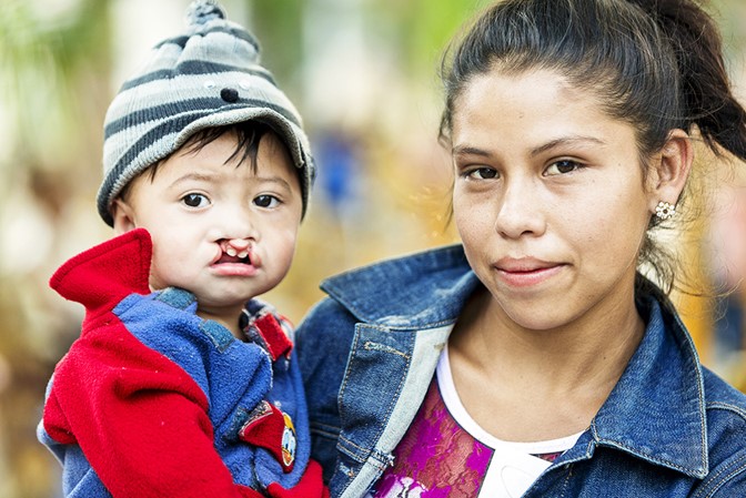 20 NUOVI SORRISI PER L’HONDURAS di Fondazione Operation Smile Italia Onlus 20 NUOVI SORRISI PER L’HONDURAS-Fondazione Operation Smile Italia Onlus