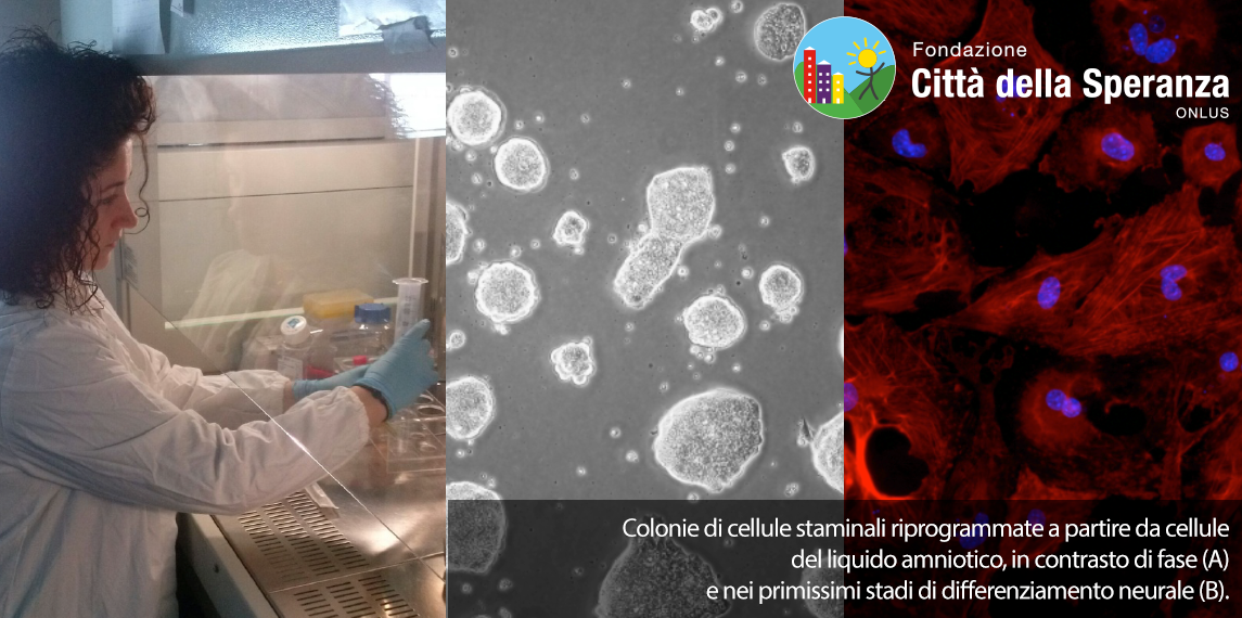 Una terapia per i difetti genetici di Città della Speranza Una terapia per i difetti genetici-Città della Speranza